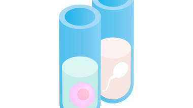 供卵助孕包男孩_供卵试管联系方式_胚胎移植前孕酮高对试管婴儿有影响吗？